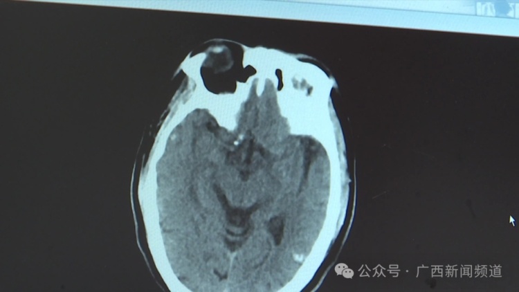 老人在医院里晕倒，竟是因为吃了这个……