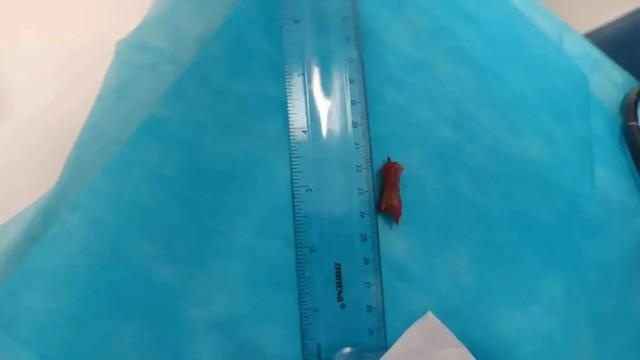 吃粽子一定要小心它！处理不对可能要命