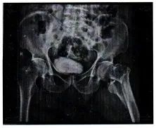 为拍一张打卡照，游客意外撞倒老人致伤残，法院判了！