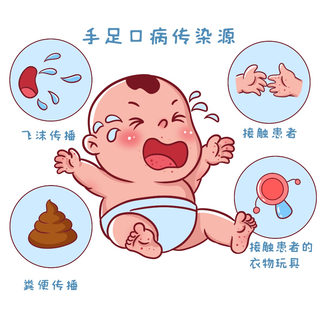 重症手足口病原正在演变，有暴发风险？