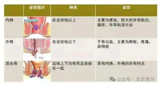 痔在身体,疮在心里 痔在身体,疮在心里