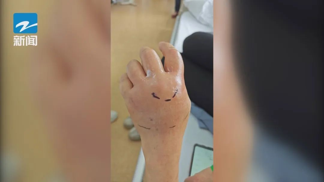 险些被截肢!起因又是这一日常的小动作,紧急提醒 险些被截肢!起因又是这一日常的小动作,紧急提醒