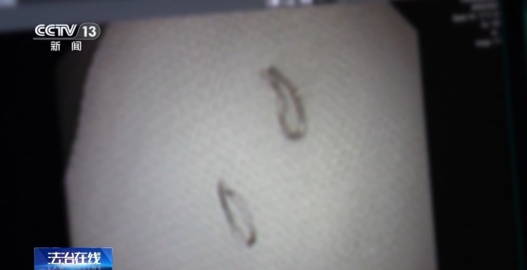 吞铁丝、口含玻璃碴敲诈餐饮店 这些犯罪团伙已被抓获！