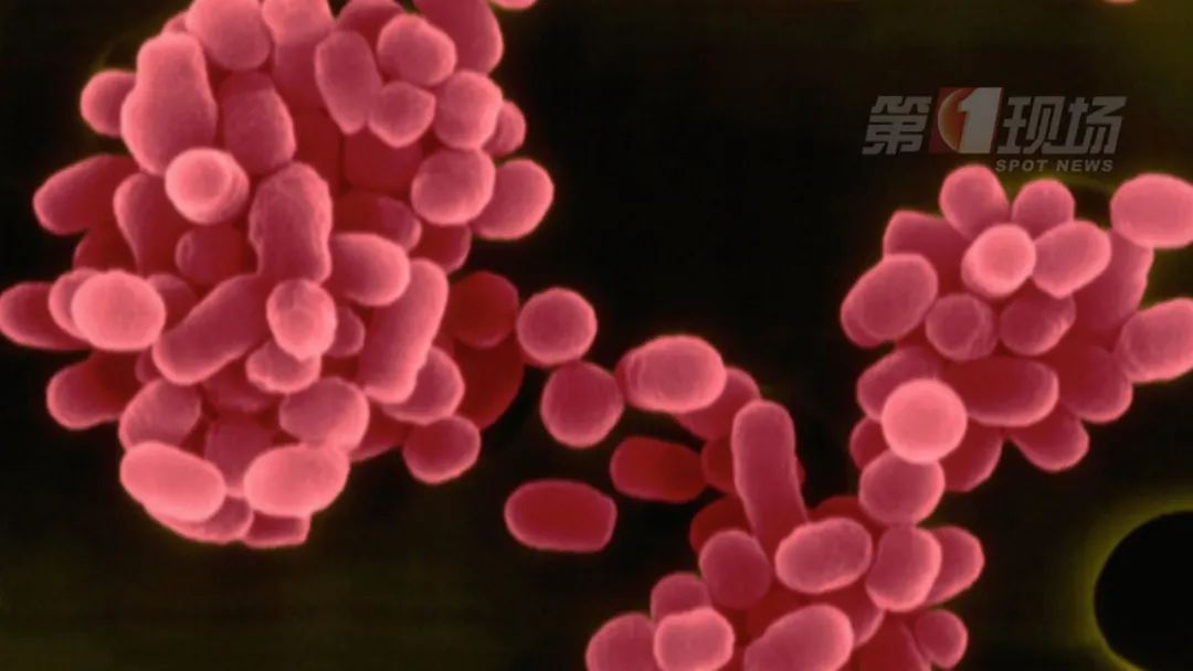 被羊咬了一口,深圳男子反复高烧不退,病因原来是→ 被羊咬了一口,深圳男子反复高烧不退,病因原来是→