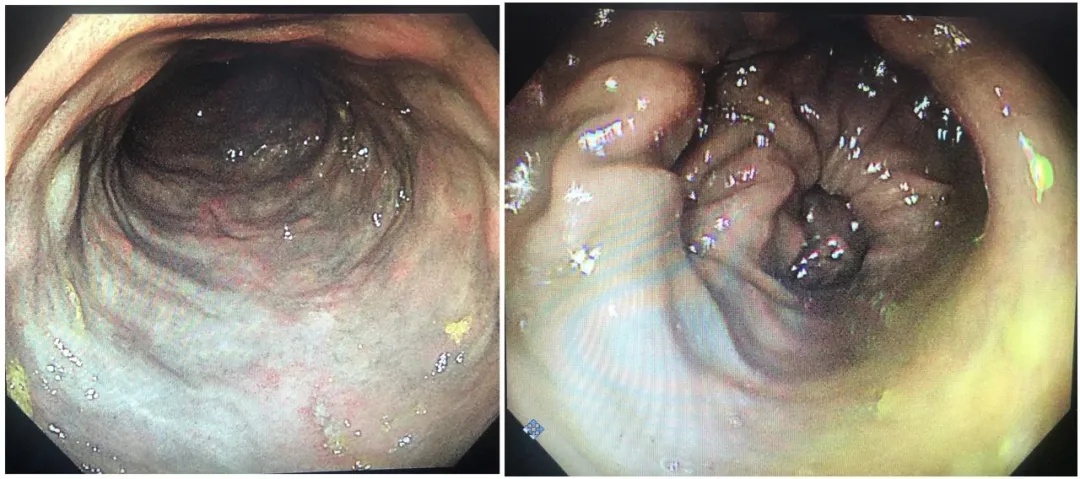 太突然,价格猛涨10倍!商家直呼“做梦都没想过!”但很多人都搞混了…… 太突然,价格猛涨10倍!商家直呼“做梦都没想过!”但很多人都搞混了……