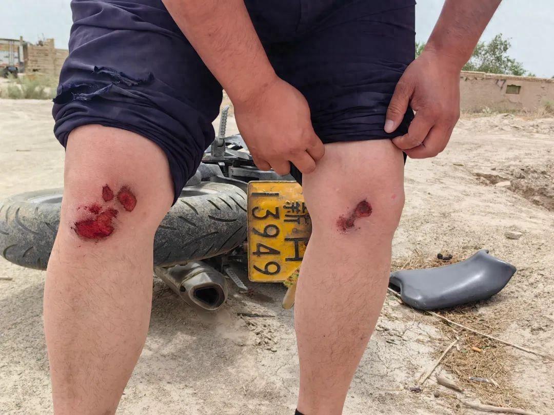 太拼了！辅警被拖行十几米后，把犯罪嫌疑人抓住了！