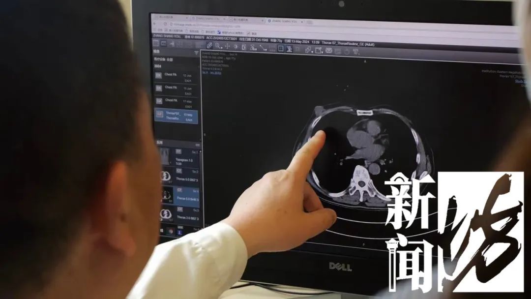 难以启齿！男子确诊这种病，有人羞于就诊，多名男星也得过