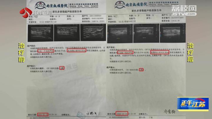 锐观察│理疗美容行业预付费调查