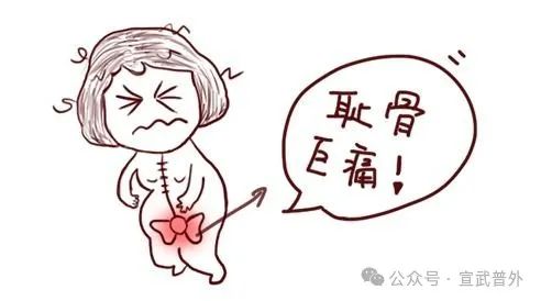 耻骨巨痛，原来淋巴结惹的祸