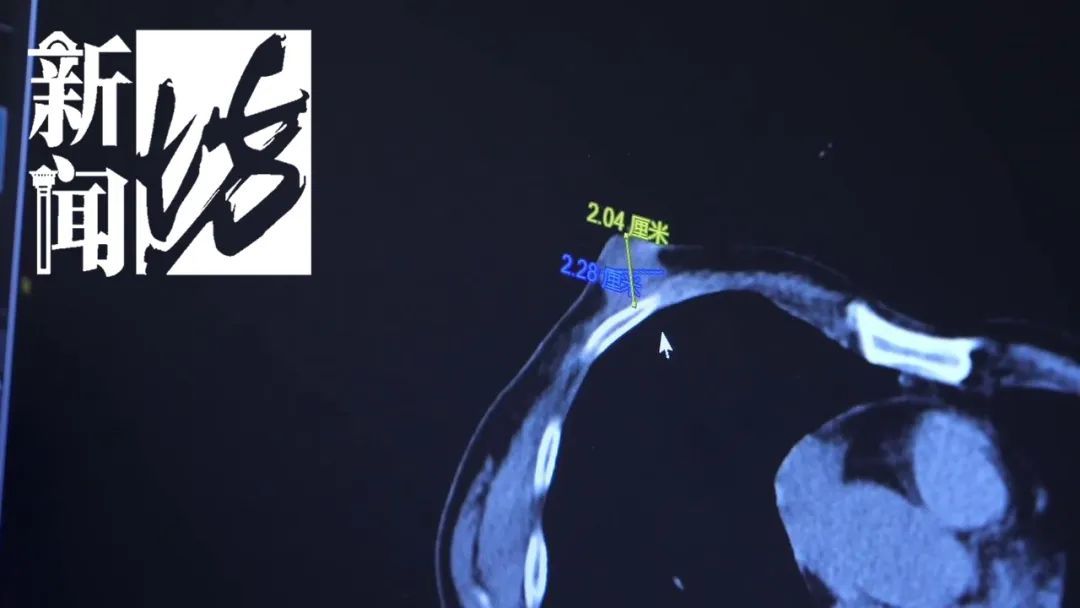 难以启齿！男子确诊这种病，有人羞于就诊，多名男星也得过