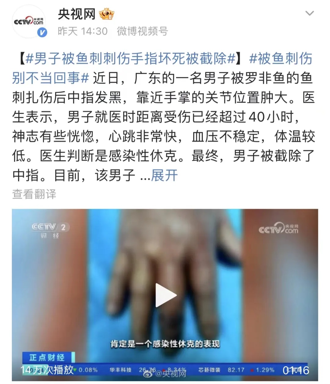 39.7℃！出现1例！医生：72小时可夺命