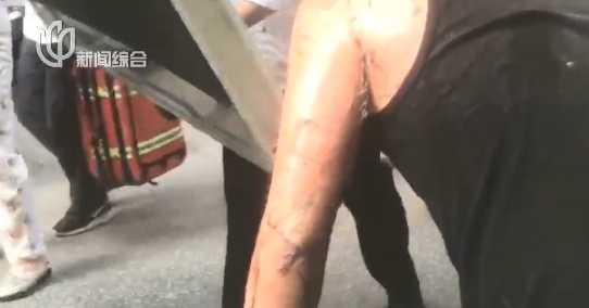 沪一小区发生火灾！男子严重烧伤：我犯罪了...