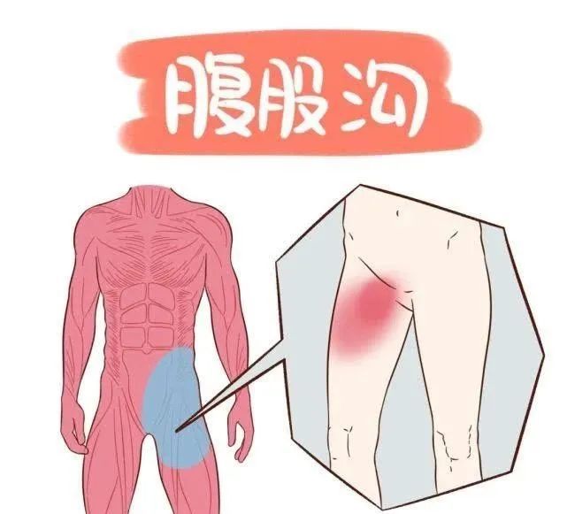 耻骨巨痛，原来淋巴结惹的祸