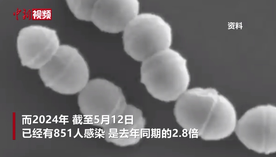 罕见细菌蔓延日本!感染后48小时可致命 罕见细菌蔓延日本!感染后48小时可致命