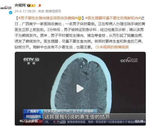 男子爱吃生猪肉猪血导致突发癫痫 医生提醒