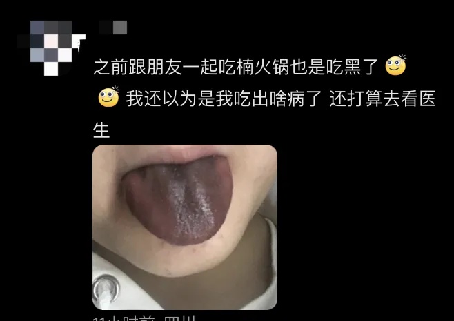 网红连锁火锅店吃完舌头发黑像中毒?品牌回应! 网红连锁火锅店吃完舌头发黑像中毒?品牌回应!
