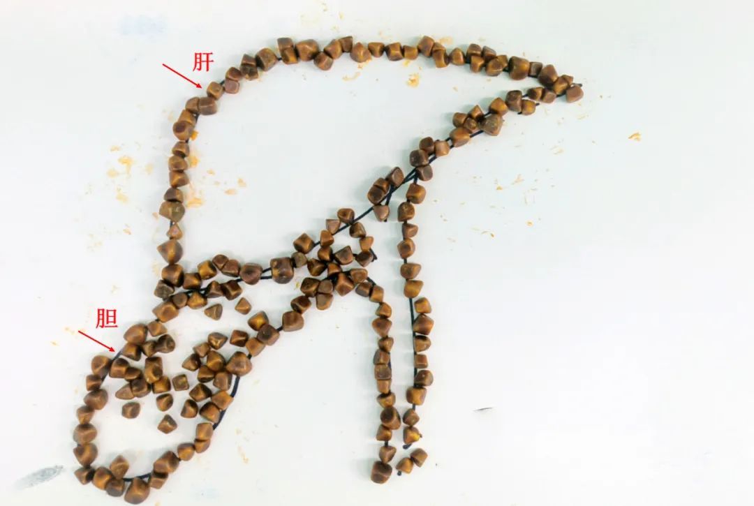 一个粽子，浙江男子半夜紧急送医！医生吓一跳：体内密密麻麻……