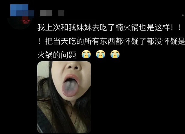 网红连锁火锅店吃完舌头发黑像中毒?品牌回应! 网红连锁火锅店吃完舌头发黑像中毒?品牌回应!