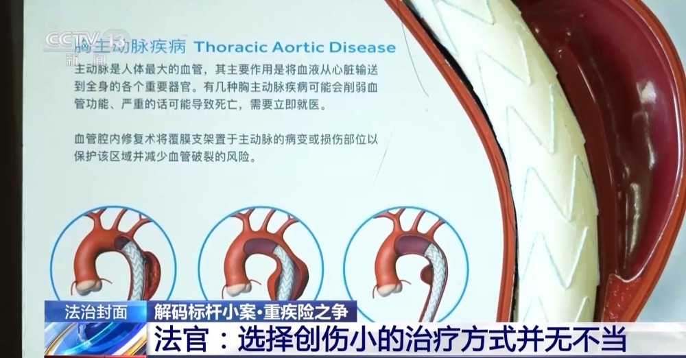 法治在线丨买了重疾险却不能赔付？化解理赔难题法院这样判→