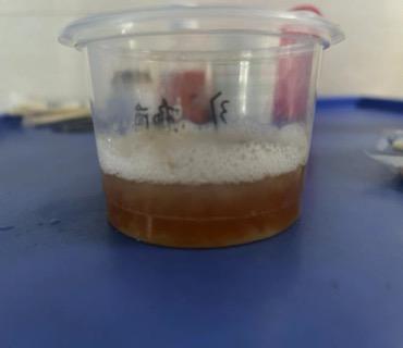 接连收治两例！因使用长期未清洗的空调后肺部感染，有人还咳出橘红色痰液