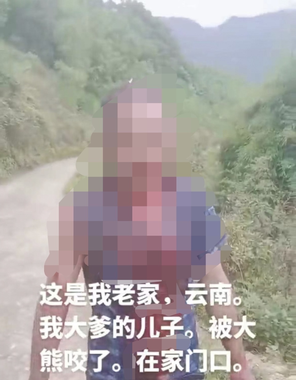 云南一村民遭熊抓伤!当地:皮外伤已就医,林草部门制定了防护措施 云南一村民遭熊抓伤!当地:皮外伤已就医,林草部门制定了防护措施