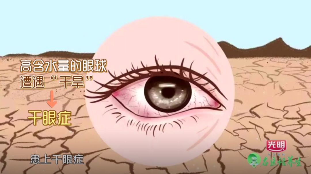 眼睛怕光、流泪、刺痛？教你4招缓解干眼症！总有一招适合你！