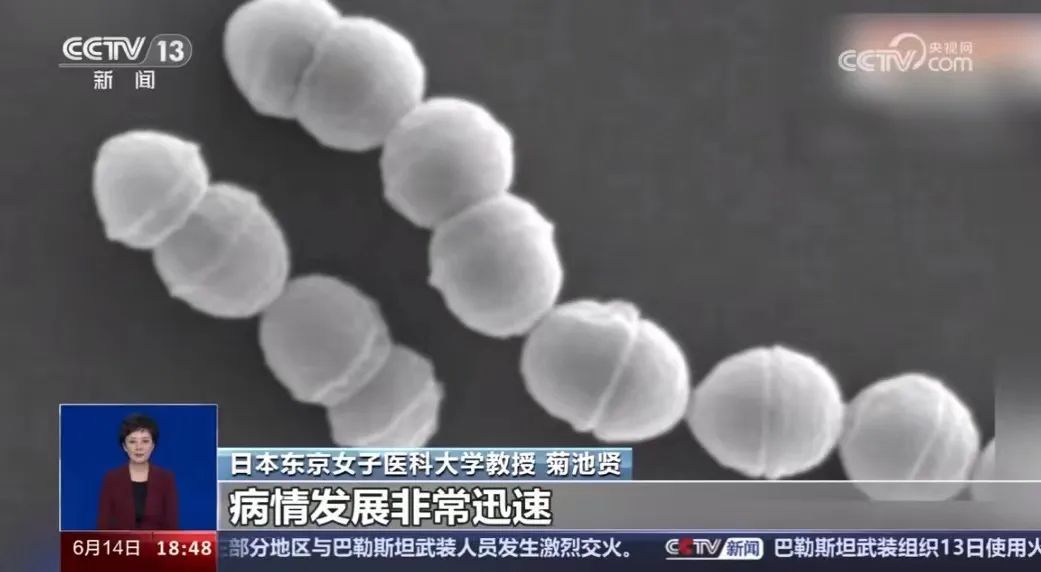 有传入国内风险！感染后48小时可致命！症状与感冒类似→