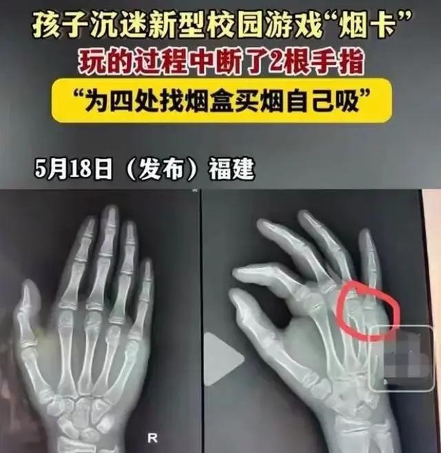 危险！为了得到烟卡，贵州三名小学生竟然这样做！家长们要警惕了！