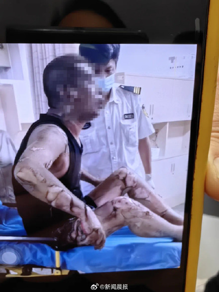 上海一女子把电动车电池带回家充电致火灾丈夫被烧伤,被拘留10日 上海一女子把电动车电池带回家充电致火灾丈夫被烧伤,被拘留10日