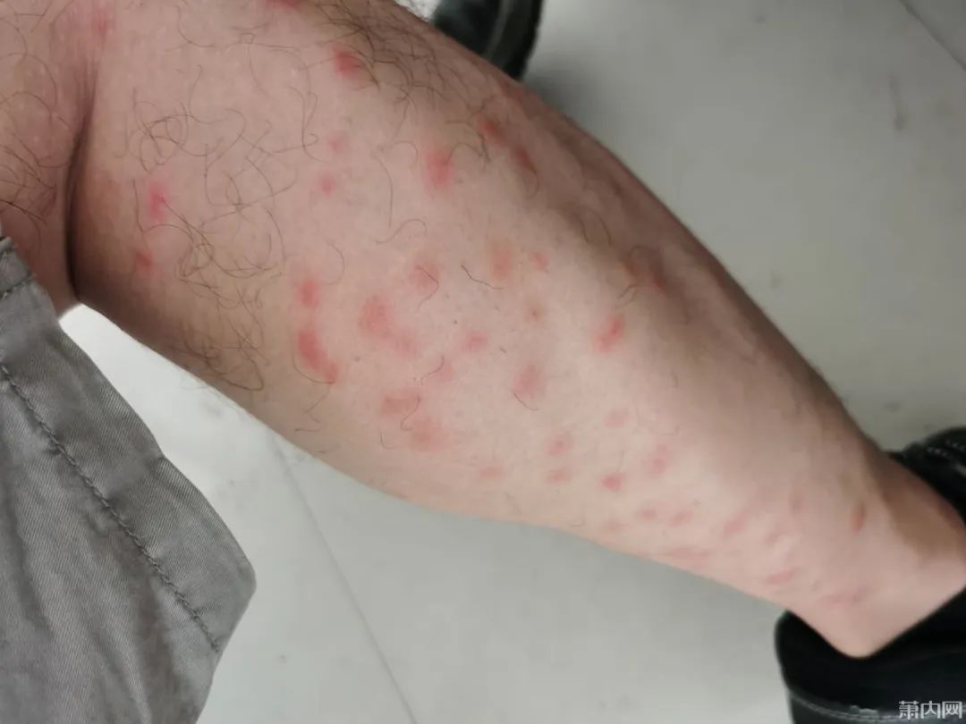 头皮发麻!小伙湖边走了圈,回家傻眼了!太狠了…… 头皮发麻!小伙湖边走了圈,回家傻眼了!太狠了……