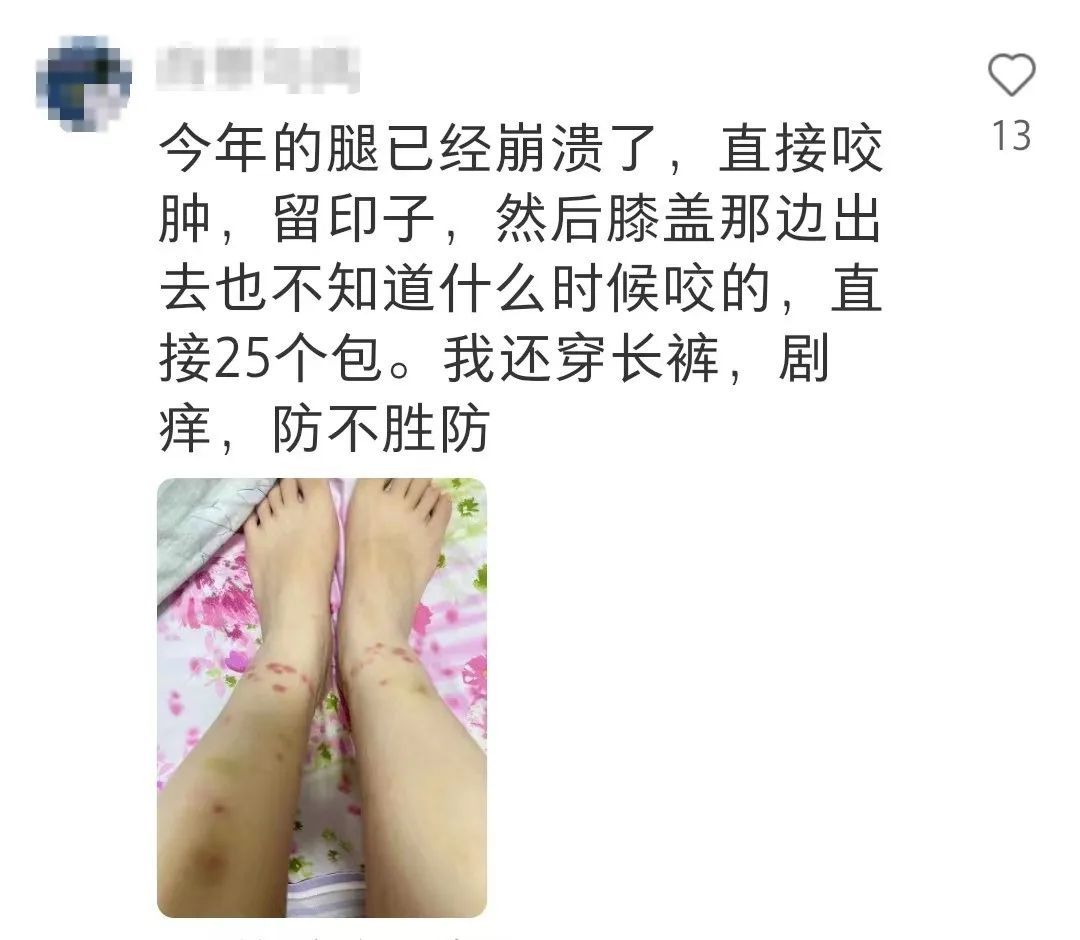 已到高发期！青岛也有人中招，不少人晒出照片：痒到崩溃……