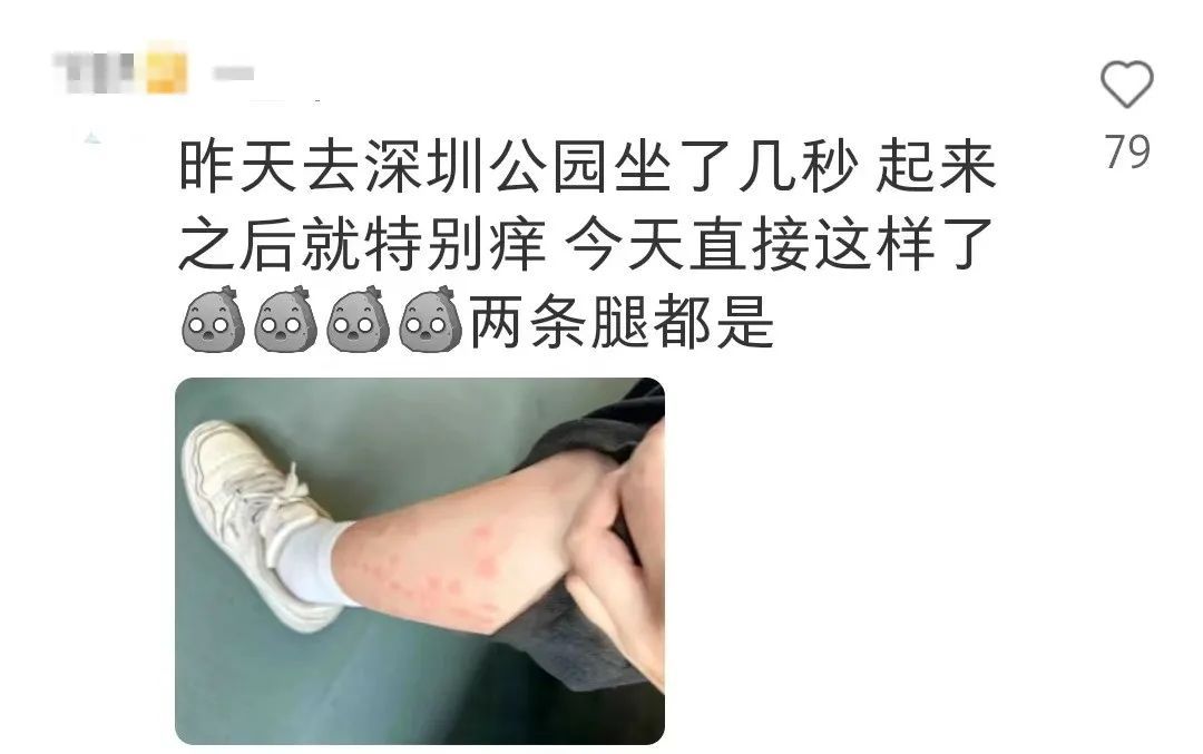 已到高发期！青岛也有人中招，不少人晒出照片：痒到崩溃……