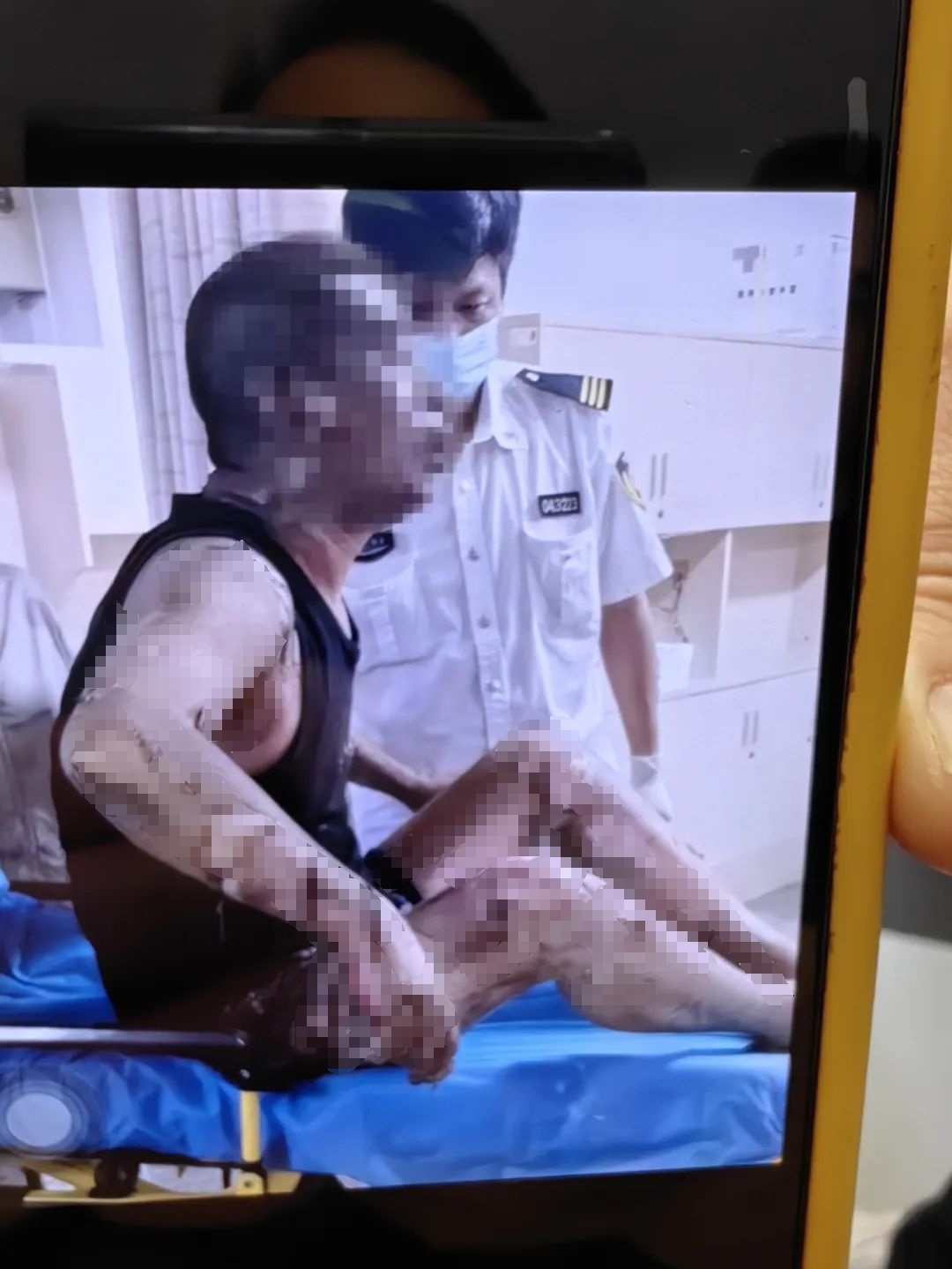 害人害己!上海一女子将电瓶拿回家充电致丈夫严重烧伤,自己被行拘10日 害人害己!上海一女子将电瓶拿回家充电致丈夫严重烧伤,自己被行拘10日