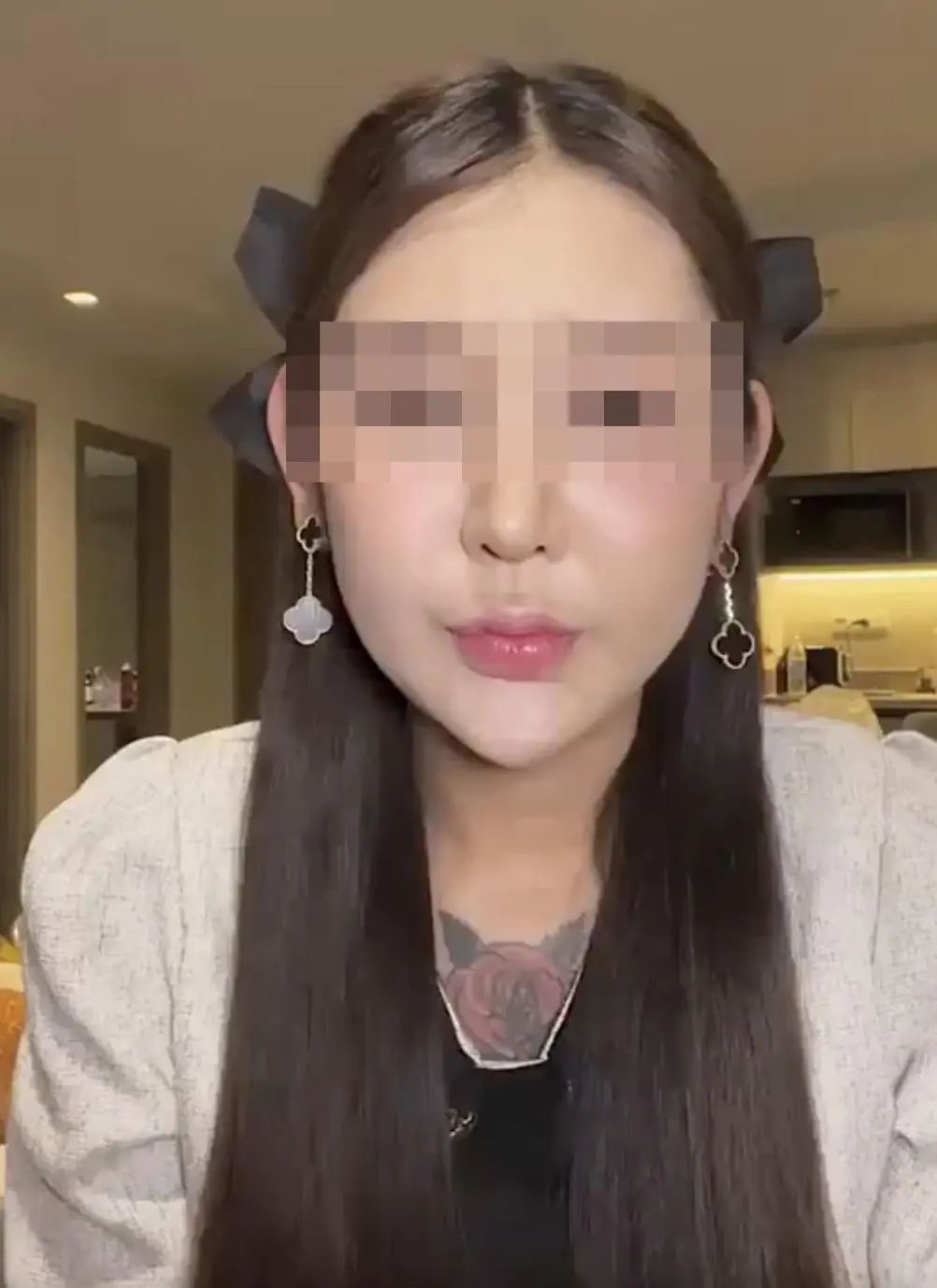 女子为美臀注射400支玻尿酸致感染！整形变美警钟再响