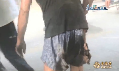 害人害己!上海一女子将电瓶拿回家充电致丈夫严重烧伤,自己被行拘10日 害人害己!上海一女子将电瓶拿回家充电致丈夫严重烧伤,自己被行拘10日