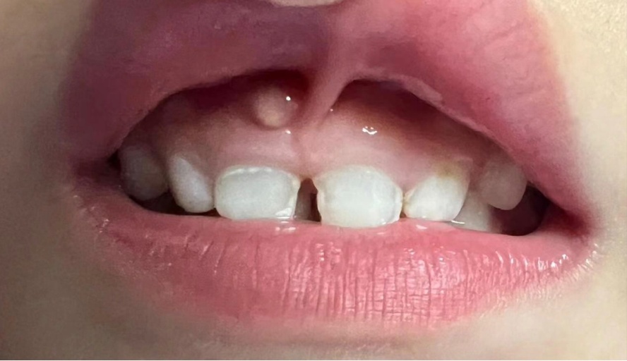 暑假来了,准备带孩子看牙科?口腔护理这些误区,一文全解析 暑假来了,准备带孩子看牙科?口腔护理这些误区,一文全解析