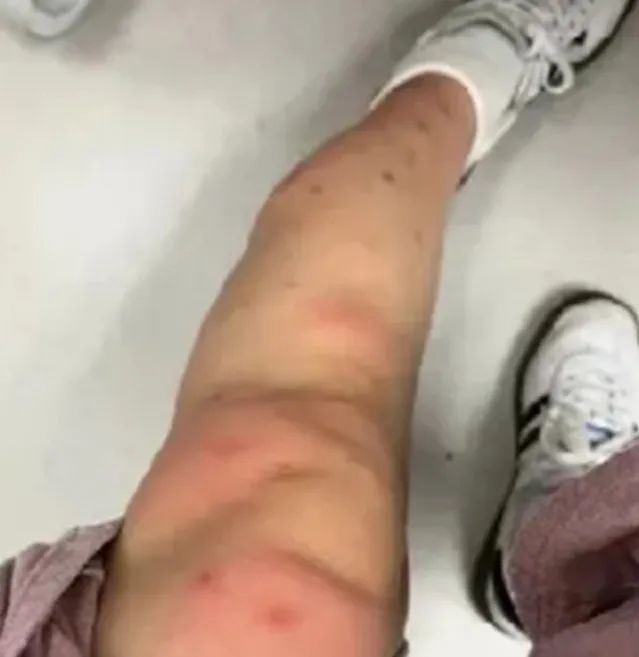 崩溃！近期猛增，不少两广人中招