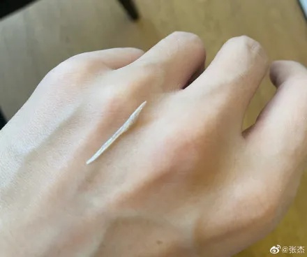 知名歌手自曝！“差点要了命”！