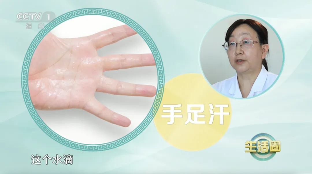 注意！这4个部位出汗多，可能暗示身体有问题→