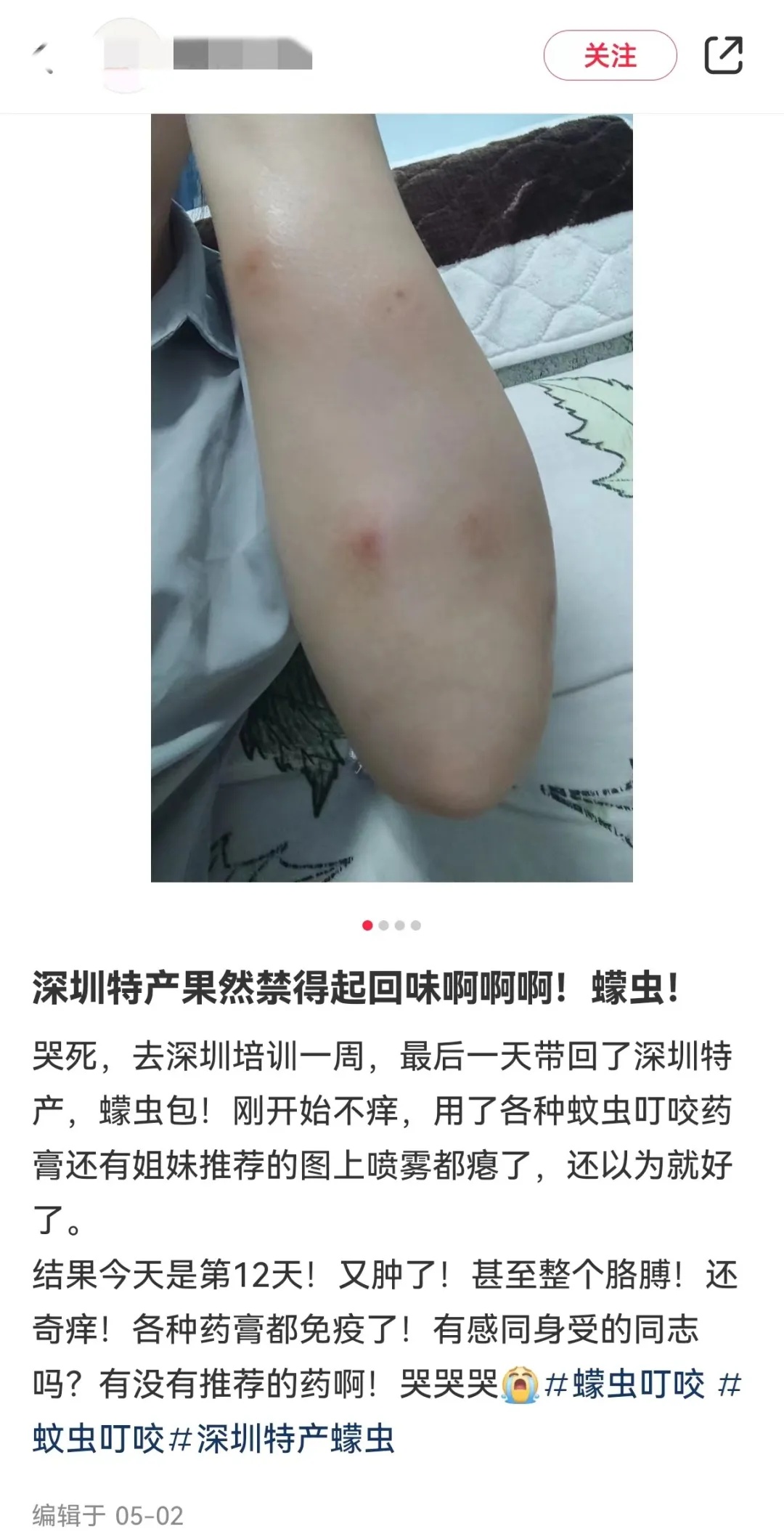 比蚊子还毒，被咬后奇痒！今年第一批中招的人出现了