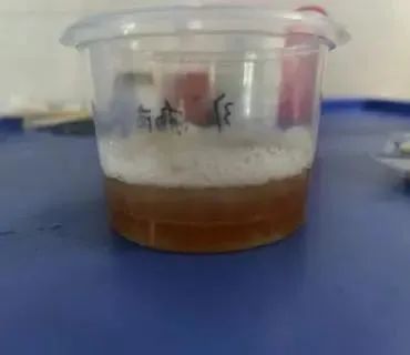 已有人确诊!几乎家家都在用 已有人确诊!几乎家家都在用