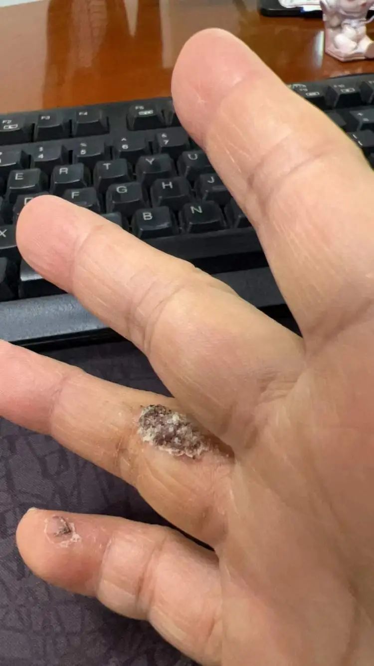 近期高发!上海有医院一天看诊500人次,医生紧急提醒→ 近期高发!上海有医院一天看诊500人次,医生紧急提醒→