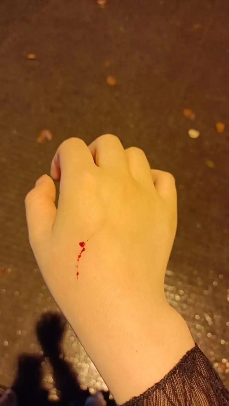 上海有医院一天看诊500人次！梅雨季高发，医生提醒：不要这么做→