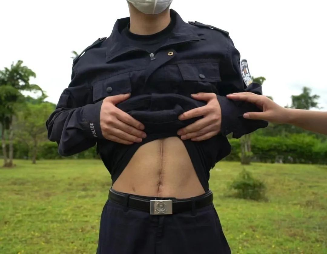 缉毒民警身上的伤疤，是长在血肉里的“勋章”