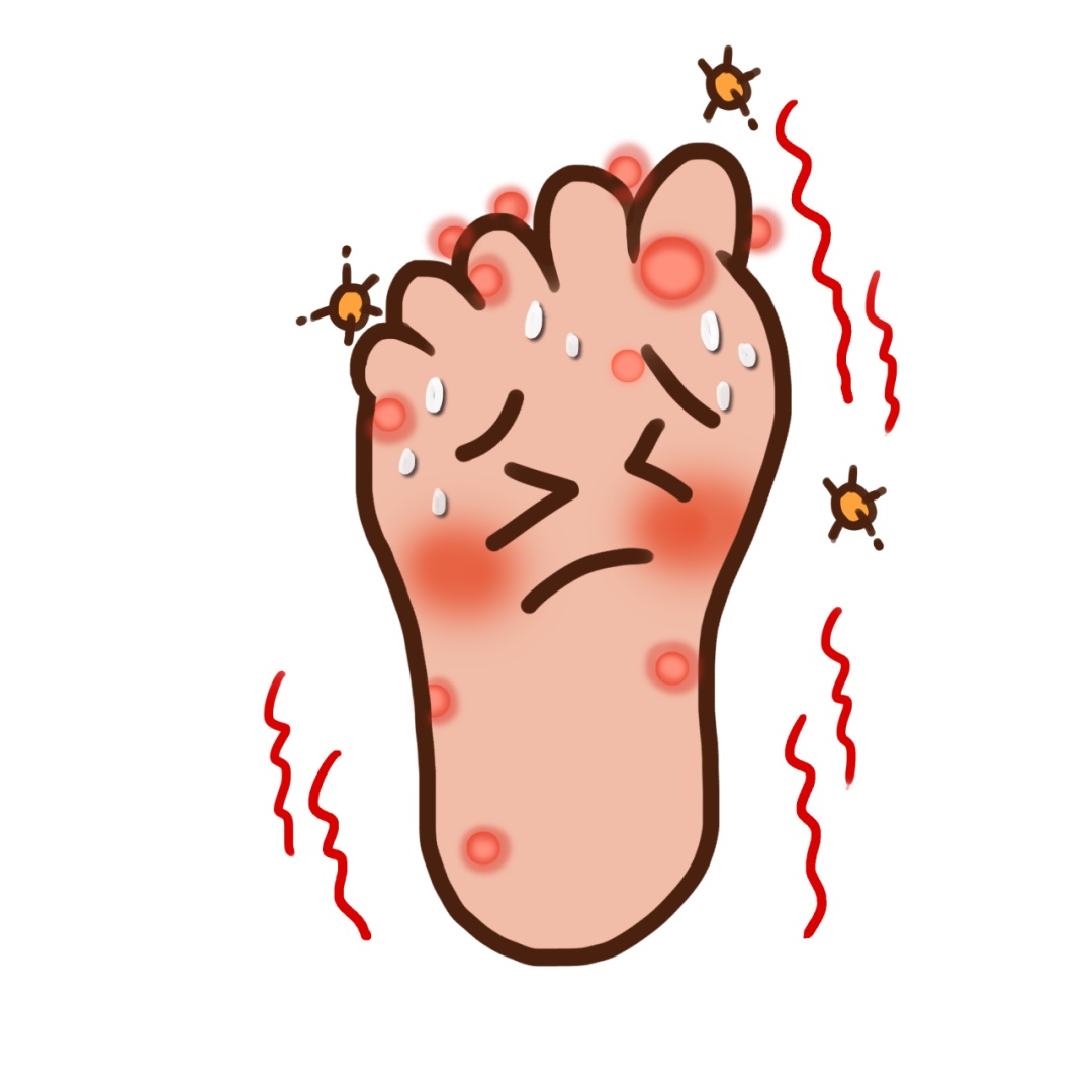 夏季这病高发,传别人,还传自己! 夏季这病高发,传别人,还传自己!