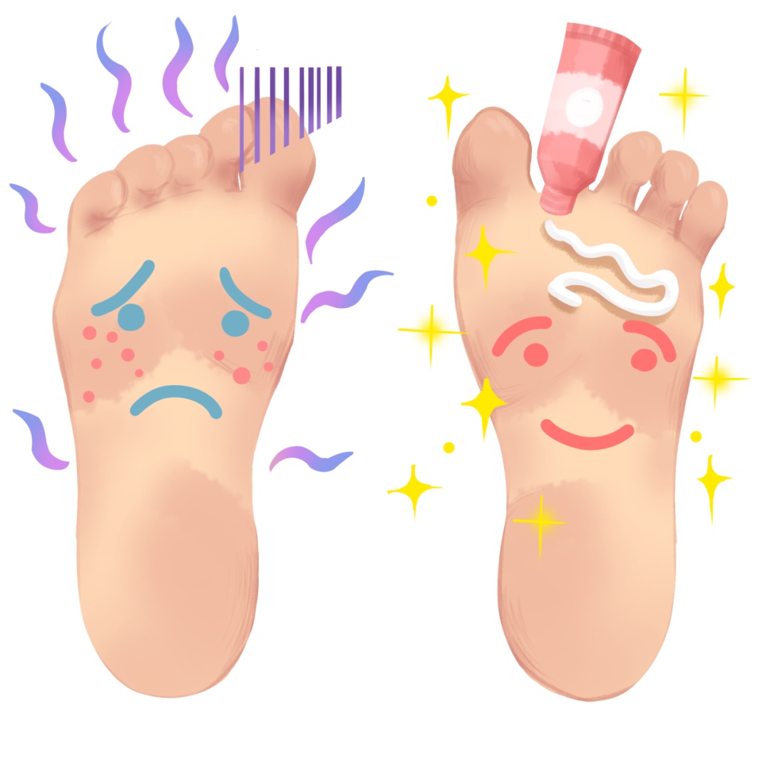 夏季这病高发,传别人,还传自己! 夏季这病高发,传别人,还传自己!