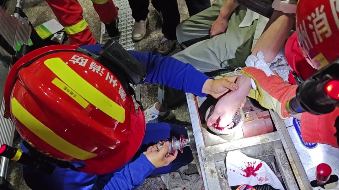 仅一瞬间，21岁的他4根手指被绞断