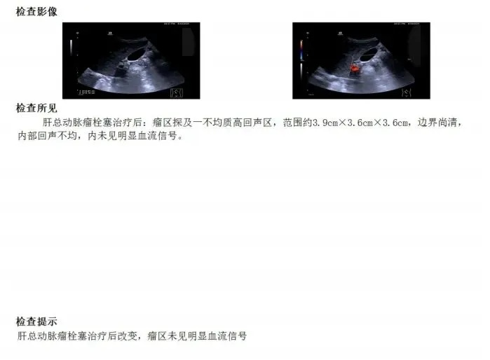 男子体检后傻眼：体内竟有颗“定时炸弹”！情急之下，医生选择这样做……