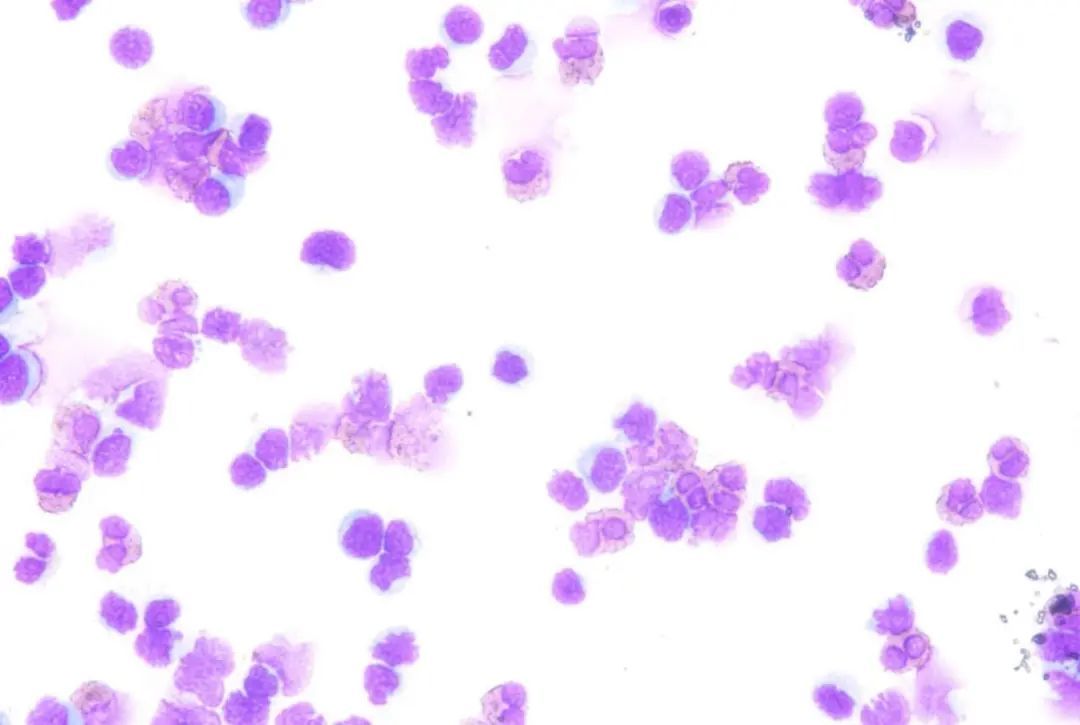 常去菜地玩且爱咬手指……2岁男童被诊断脑内“钻”进寄生虫