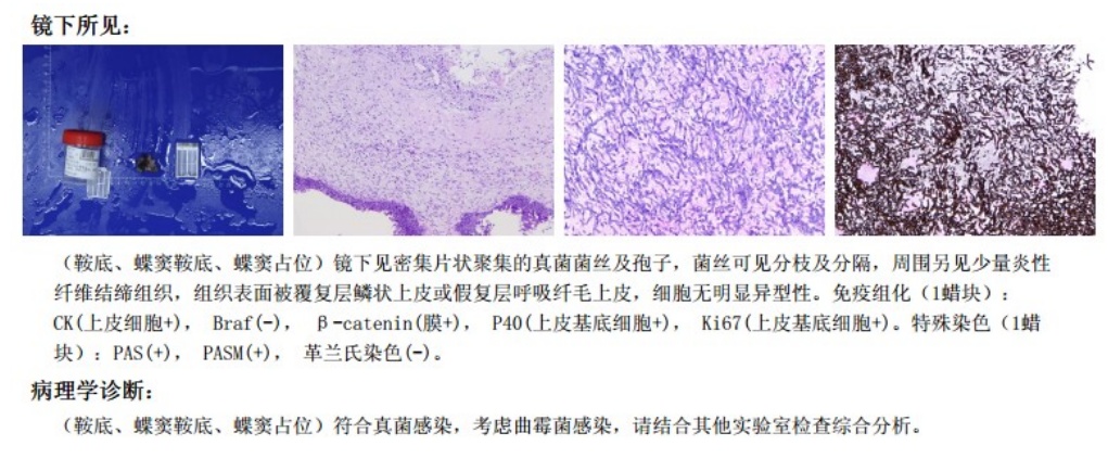 眼睛疼竟是脑袋“发霉”?@上海人:出梅后也有黄梅病,高温天警惕这两种天气→ 眼睛疼竟是脑袋“发霉”?@上海人:出梅后也有黄梅病,高温天警惕这两种天气→